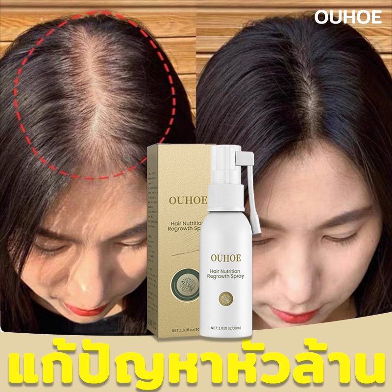 สเปรย์ ปลูกผม ของแทัOUHOE สเปรย์ปลูกผม 30ML ป้องกันผมร่วง เซรั่มปลูกผม บอกลาหัวล้าน ลดผมร่วง น้ำยาปลูกผม