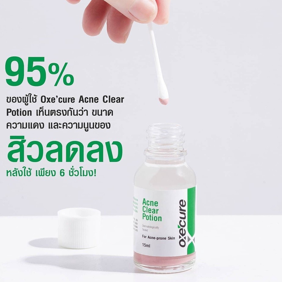 แต้มสิว แป้งน้ำชมพูลดสิว 15ml OxeCure Acne Clear Potion จากประเทศญี่ปุ่น ลดสิว รอยดำ