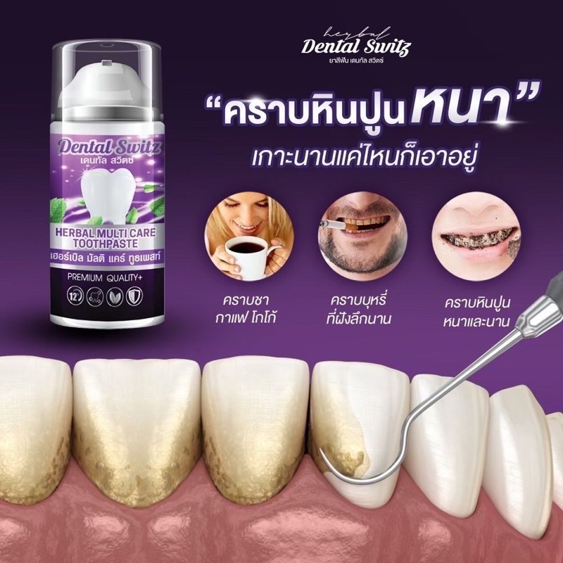 ยาสีฟันฟอกฟันขาวDentalswitz  เจลฟอกฟัน ลดกลิ่นปาก คราบหินปูน