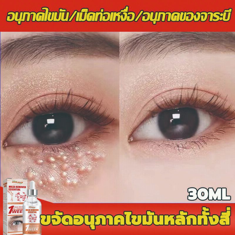South Moon 30ML อายครีม กำจัดเม็ดไขมันใต้ตา ครีมทาเม็ดไขมันใตตา ลดเลือนริ้วรอยความหมองคล้ำปรับปรุงถุงใต้ตา อายเซรั่ม
