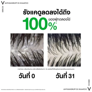 [ส่งด่วน] VICHY DERCOS ANTI DANDRUFF SHAMPOO 200ML ยาสระผมขจัดรังแค ช่วยดูแลหนังศีรษะ แชมพู วิชี่ เดอร์คอส