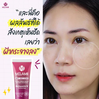 8G l ครีมทาฝ้า ลดฝ้า Melamii Anti-Melasma Perfect White Serum and Spot Corrector