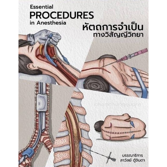 หนังสือ หัตถการจำเป็นทางวิสัญญีวิทยา (ESSENTIAL PROCEDURES IN ANESTHESIA) 9786164078901