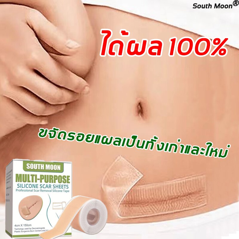 【จัดส่งจากกรุงเทพฯ】South Moon รักษารอยแผลเป็น แผ่นแปะแผลเป็น 4cm*150cm กําจัดรอยแผลเป็นจากแผลเป็น เผยผิวเนียนสวย