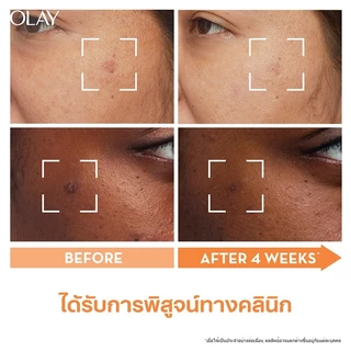 Olay Luminous โอเลย์ ลูมินัส เซรั่ม + ครีม วิตามินซี Vit C 50g + 30ml สำหรับ จุดด่างดำและสีผิวไม่สม่ำเสมอ