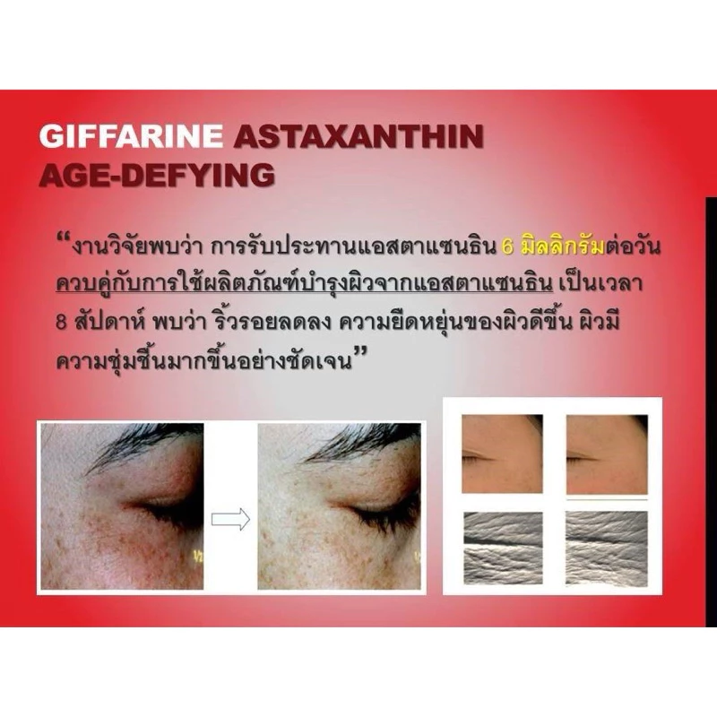 Astaxanthin GIFFARINE แอสตาแซนธิน สารสกัดสาหร่ายแดง thumbnail 5