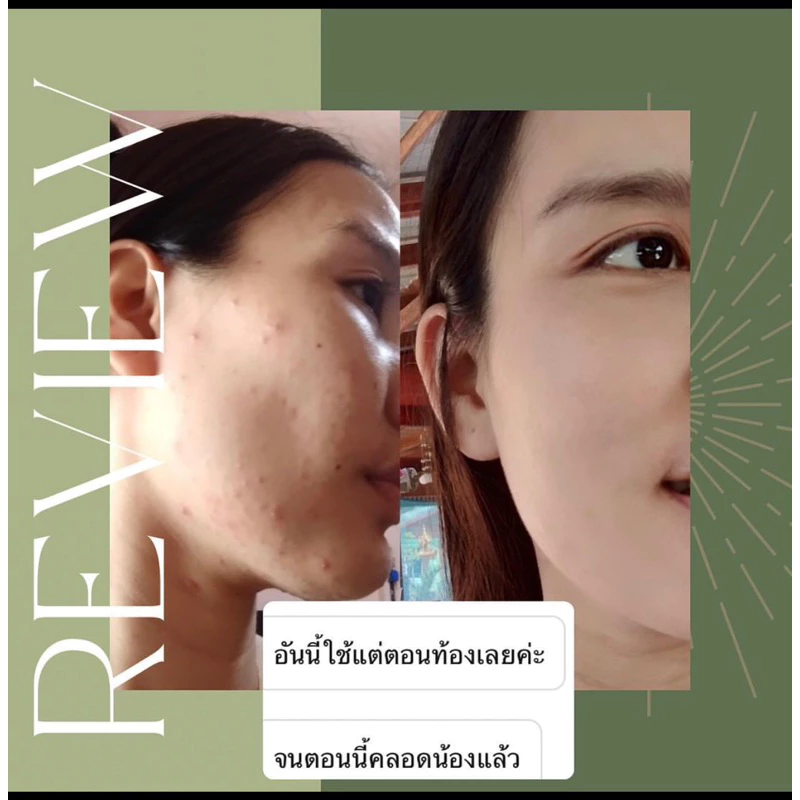 Mevi Moisturizer เมวี่มอยซ์เจอร์ไรเซอร์ 30g thumbnail 6