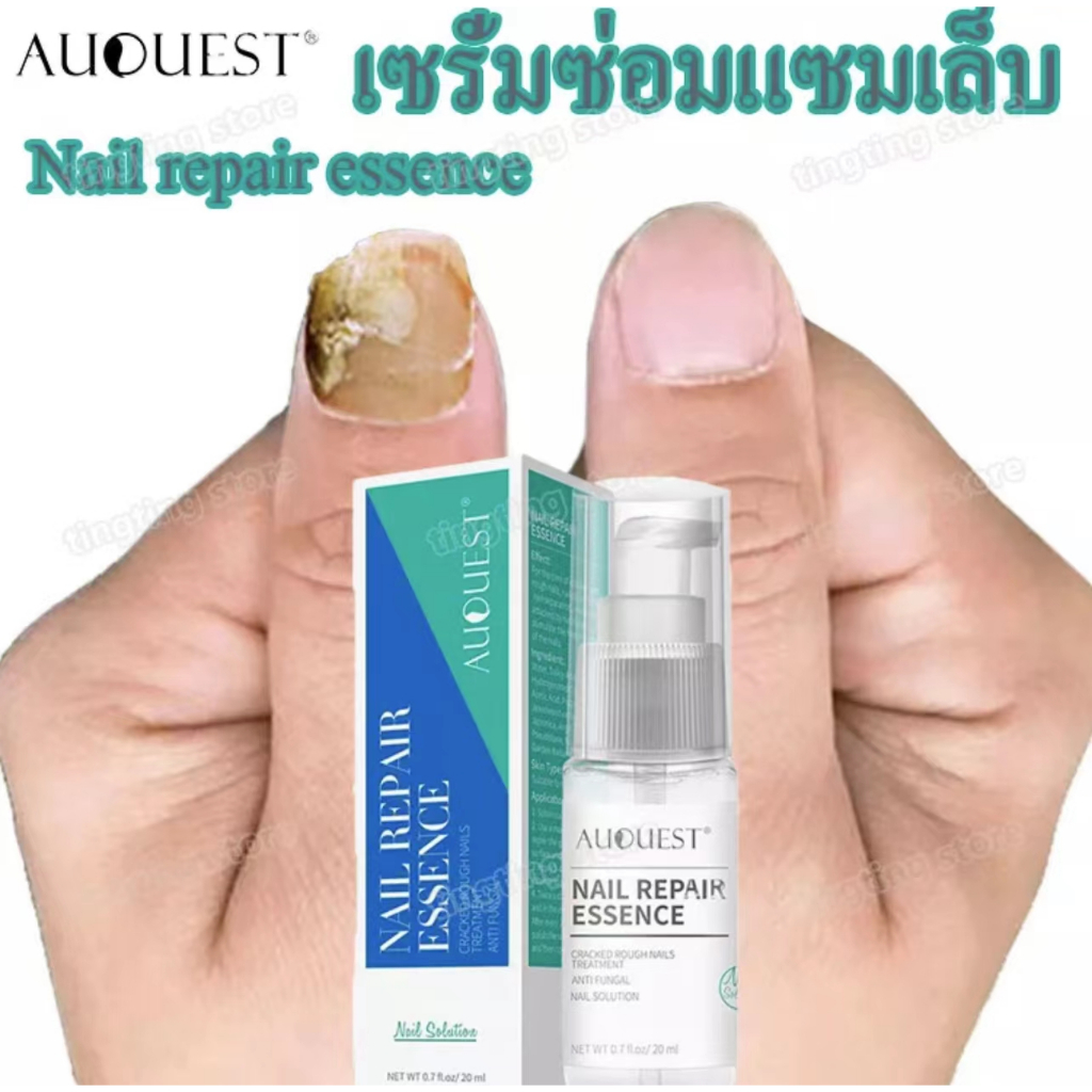*pwj0o1w0mh*เซรั่มทาเล็บ  20ml.น้ำมันทาเล็บ เซรั่มทาเล็บเสีย ออยทาเล็บ เล็บเท้า เชื้อราเล็บมือ
