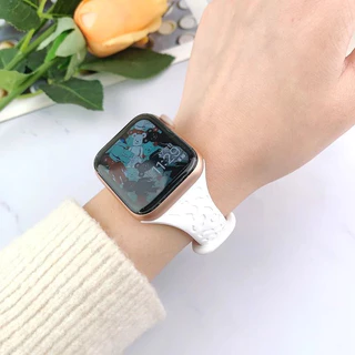 เสือดาวพิมพ์สายนาฬิกาซิลิโคนเหมาะสำหรับ iWatch series11 10 9 8 7 6 se ultra 49mm44mm45mm i watch5 4 3 2 41mm38mm40mm42mm