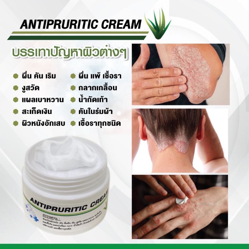 ANTIPRURITIC CREAMครีมแก้คันแก้แพ้ (เห็นผลจริง ตั้งแต่ปุกแรก)(ของแท้100%) มีร้านเดียวลดผื่นคัน