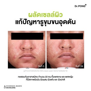 Refill pack 300 ml Dr.PONG p55 BHA Acne Clear face wash เจลล้างหน้าสูตรอ่อนโยน