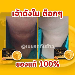 ครีมขมิ้นHerbal ครีมขมิ้นเฮอร์เบิล บำรุงใบหน้า ลดรอยดำ คอดำ ขาหนีบดำ จักแร้ดำ (แท้จากบริษัท)