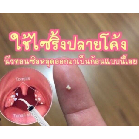 ไซริ้งค์ปลายโค้ง2ชิ้น กำจัดนิ่วทอนซิล ไซริ้งฉีดฟันคุด ถูกที่สุด พร้อมส่งจากไทย