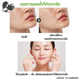 MISSNALA ESSENCE ALOE GEL เนื้อเจล บำรุงผิวและซ่อมแซมผิว จากปัญหาสิว สารสกัดจากว่านหางจระเข้ 99% 248966
