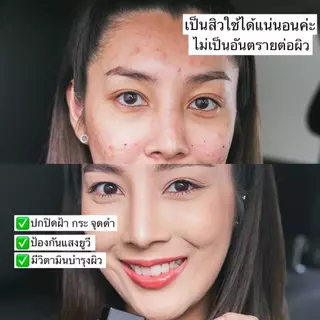 ✅ พร้อมส่ง ✅ รองพื้นปิดฝ้า Cherben ของแท้จากบริษัท