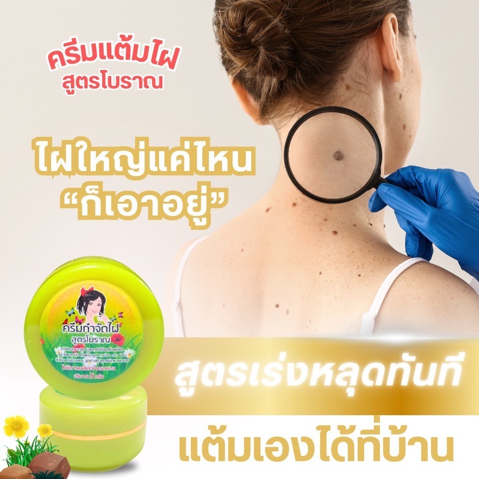 ครีมแต้มไฝ สูตรโบราณ ครีมแต้มไฝ