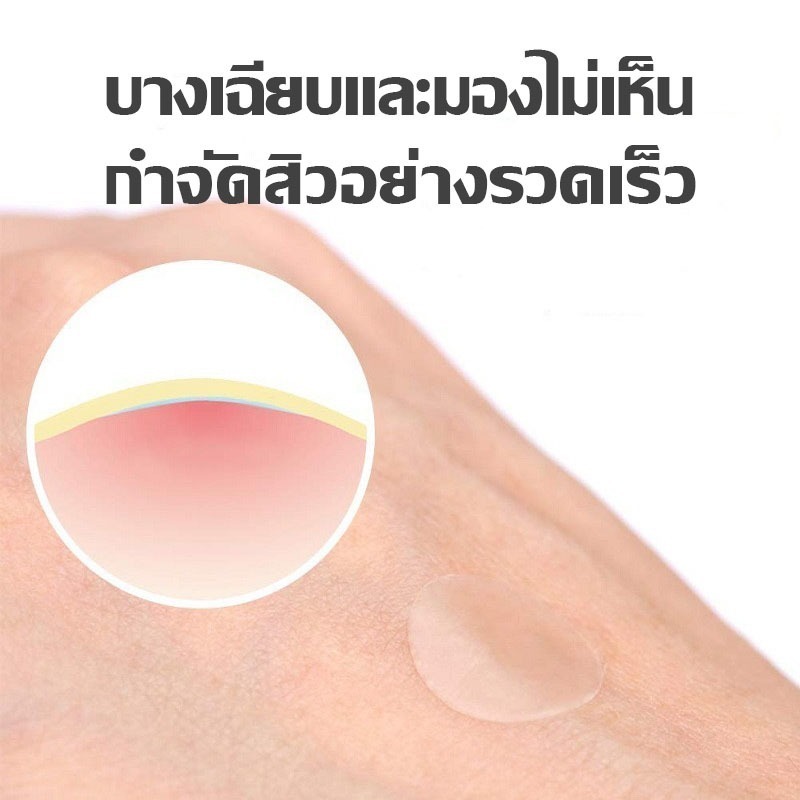 แผ่นแปะสิว แผ่นสติกเกอร์แปะสิว แผ่นแปะดูดสิว แผ่นสิว สติกเกอร์แปะสิว แผ่นดูดสิว สําหรับติดตกแต่งสิว รูปดาวน่ารัก 3 สี - รูปที่ 3