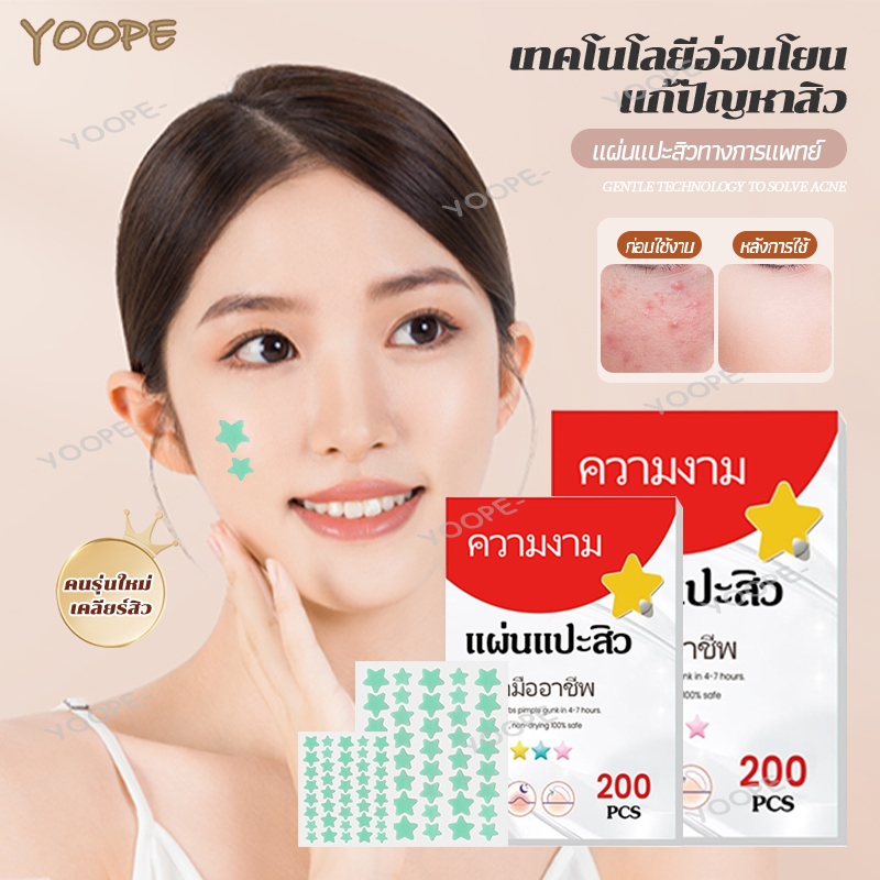 แผ่นแปะสิว แผ่นแปะรักษาสิว สําหรับติดตกแต่งสิว แผ่นสิว รูปดาวน่ารัก 200ชิ้น/ถุง 5 สี Acne Patches