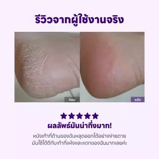 BAREN FOOT EXFOLIANT SOFTENER AT-HOME KIT 100 ML บาเรน ฟุต เอ็กซ์โฟเลียนท์ ซอฟเทนเนอร์ แอท-โฮม คิท