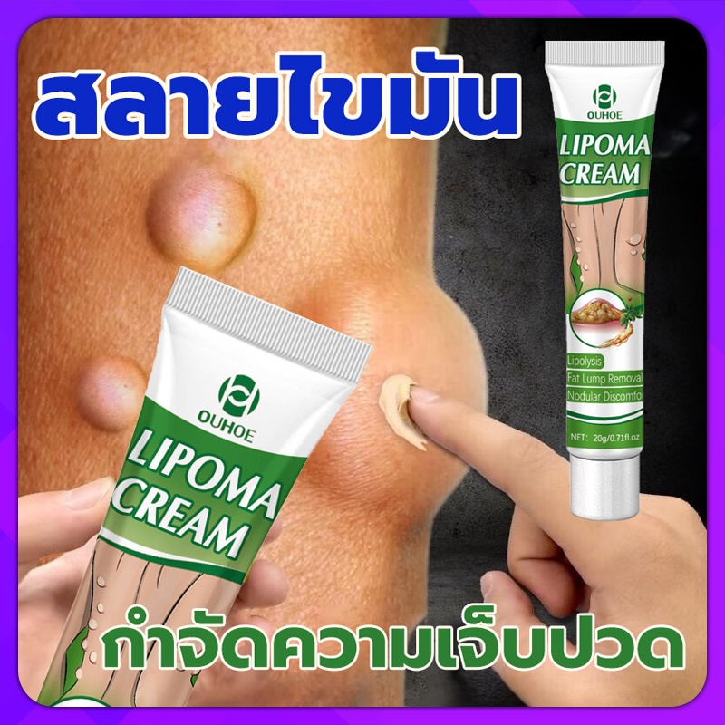 [สปอตสินค้า] OUHOE ออกแบบ36ชนิดของไขมันใต้ผิวหนังกำจัดมวลก้อนไปยังถุงน้ำ LymphCareOintment สมุนไพรกำจัด ก้อนเนื้อใต้ผิวห