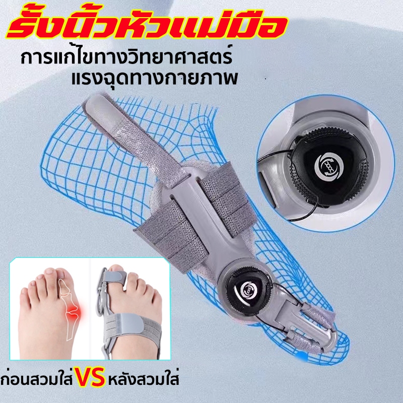 อุปกรณ์แก้ไขเท้าผิดรูป สำหรับผู้มีนิ้วโป้งเท้าเอียง เท้าเอียง ดัดเท้า เท้าเก เท้าเอียง เท้าเฉ