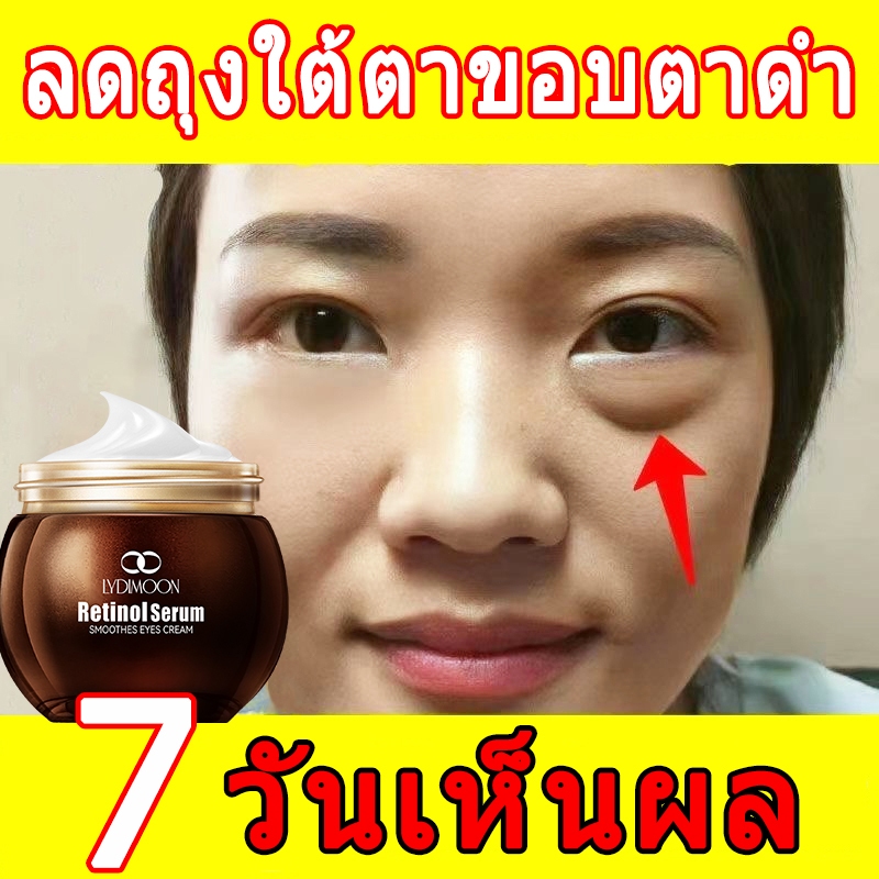 ครีมบำรุงรอบดวงตา ครีมลดริ้วรอย อายครีม ลดริ้วรอย ใต้ตาดํา ครีมเรตินอล ทาใต้ตา บํารุงใต้ตา eye cream 35g