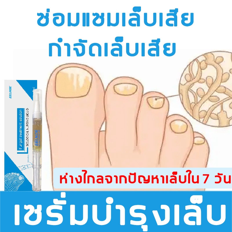【Have Strong Nails】เซรั่มซ่อมแซมเล็บ เซรั่มบำรุงเล็บ แก้ปัญหาเล็บ ​บำรุงเล็บ ต่อต้านการติตเชื้อรา ซ่อมแซมเล็บแตก.
