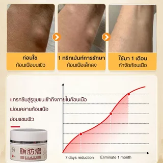 ก้อนเนื้อใต้ผิวหนัง ก้อนเนื้องอกไขมัน 30g กำจัดเนื้องอกไขมัน ก้อนเนื้อใต้ผิวหนัง