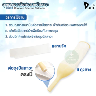 🔥ขายส่ง🔥DURA ถุงยางอนามัย ต่อสายปัสสาวะ Condom External Catheter เบอร์ 25, 30, 35, 40 mm (ยกกล่อง 50 ชิ้น)