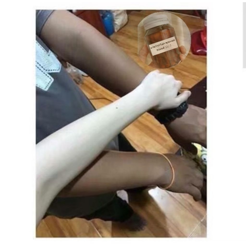 Vitamin wink clinic's