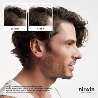 NIOXIN System 2 Shampoo สำหรับผมบางชัดเจน ผมธรรมชาติ 300ml (ไนอ๊อกซิน แชมพูลดผมขาดหลุดร่วง ทำความสะอาดหนังศีรษะ)
