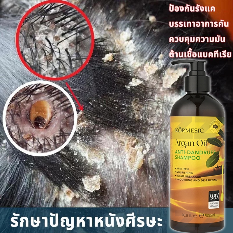โปรเฟชชั่นนอล อาร์แกนออยล์ เทอราพี แชมพู  แชมพูขจัดรังแค แชมพูคัน กำจัดรังแคและแก้คัน ปรับปรุงผมมัน บำรุงหนังศรีษะ500ML ราคา ถูกที่สุด ดีลบีเคเค