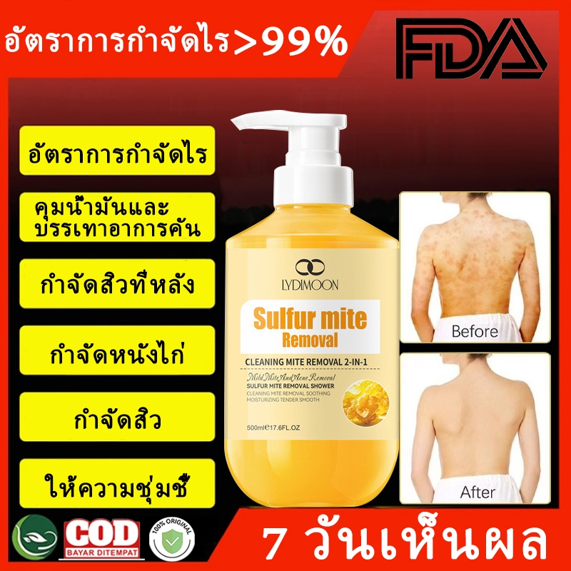 เจลอาบน้ำลดสิวกาย body wash ครีมอาบน้ํา ลดสิว แก้อาการคัน ลดสิว กำจัดไร กลากเกลื้อน ต่อมไขมันอักเสบ กลิ่นตัว กลิ่นแก่