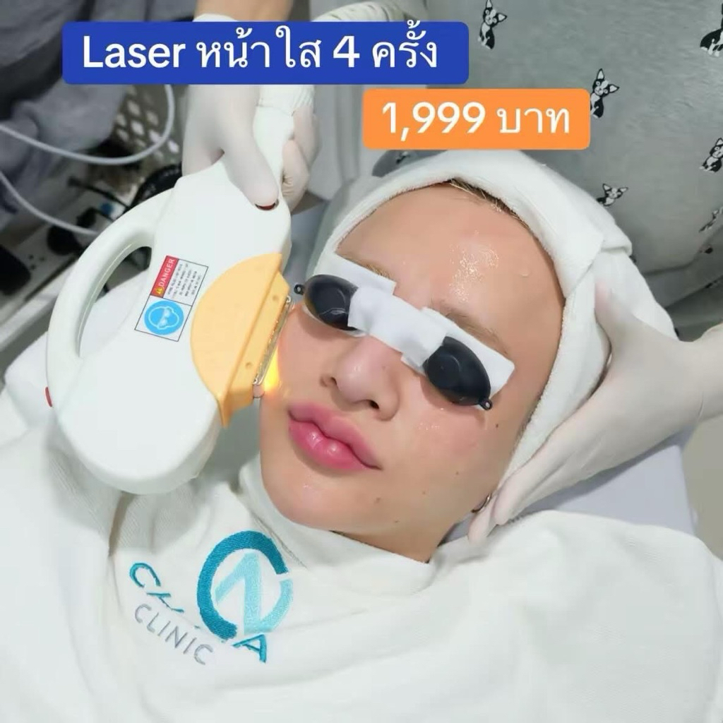 E-Light Laser 4 ครั้ง 1,999 บาท