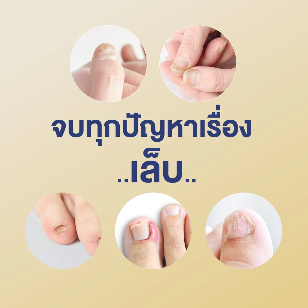 Cosma Nail Serum เซรั่มบำรุงเล็บ ลดเล็บขบ เชื้อรา thumbnail 5