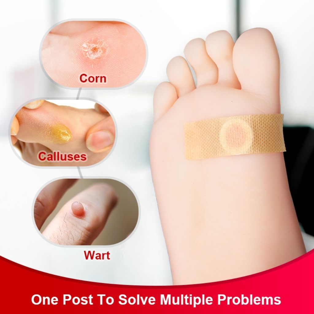 24ชิ้น/กล่อง พลาสเตอร์หูด ตาปลา Corn Plaster Removel เอ็ส โอ พลัส - 1