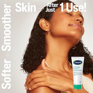 CETAPHIL ครีมผลัดเซลล์ผิว ลดขนคุด 20% Urea | Exfoliating Rough & Bumpy Cream ครีมผิวเนียน ลดหนังไก่