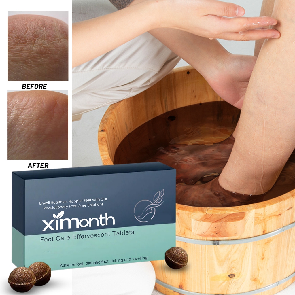 Ximonth เม็ดฟู่สำหรับดูแลเท้า ทำความสะอาดผิวที่ตายแล้วบนเท้า ให้ความชุ่มชื้น และป้องกันการแตกและลอกของเม็ดแช่เท้า.10pcs