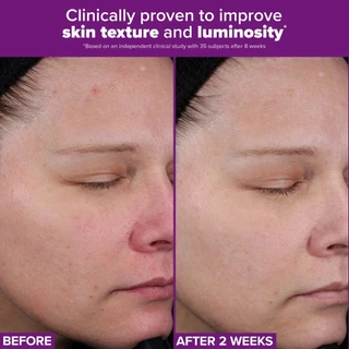 Paula's Choice PRO Retinaldehyde Treatment พอลล่าส์ ช้อยส์ โปร เรตินอลดีไฮน์ ทรีตเมนต์