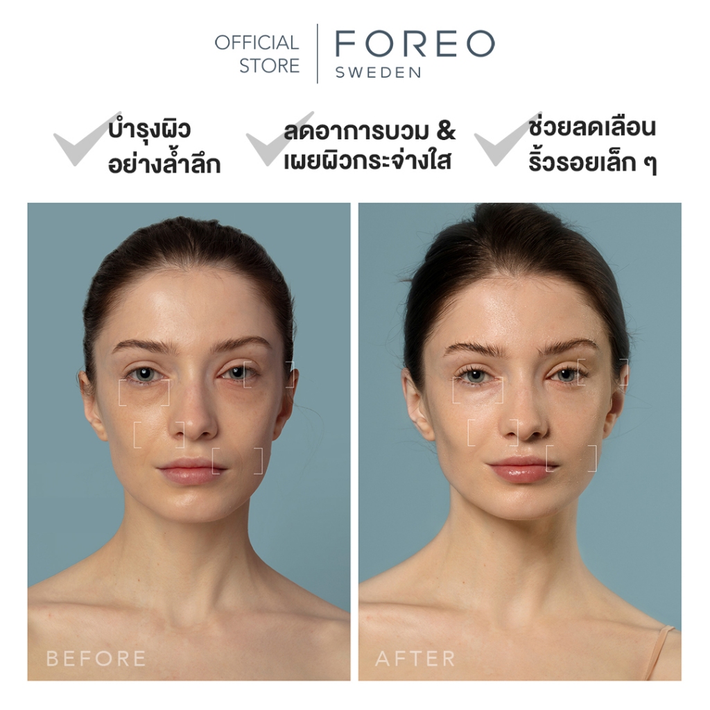 FOREO UFO 3 Black เครื่องมาส์กหน้า เติมความชุ่มชื้นล้ำลึกด้วยแสง LED+ร้อนเย็น ปรับผิวให้ดูโกลว์สวยภายใน 2 นาที - รูปที่ 3