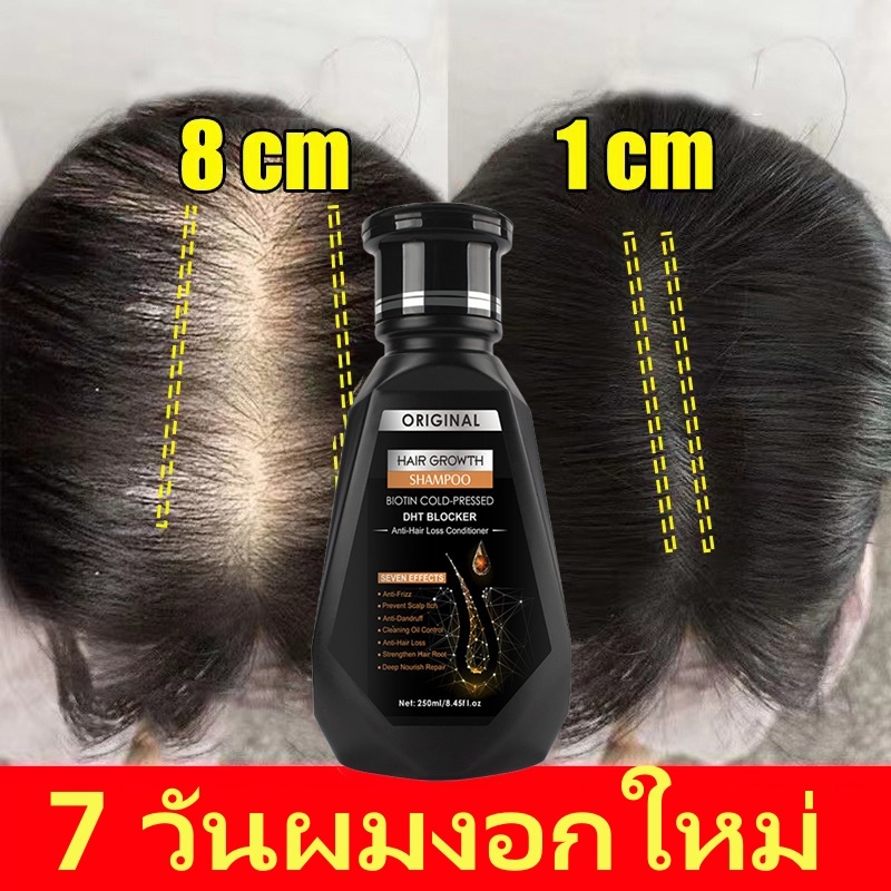 แชมพูขิง PEIMEI 250ml บำรุงรากผม ลดผมร่วง ควบคุมความมัน