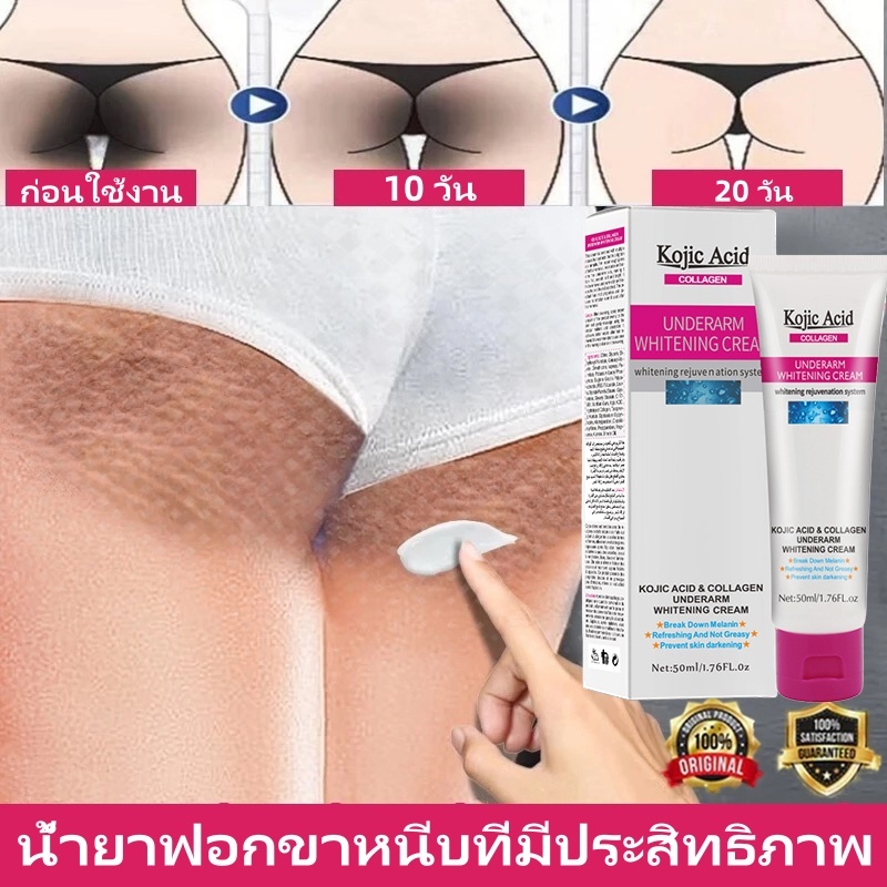 💓จัดส่งด่วน💓Kojic Acid ครีมขาวจุดซ่อนเร้น ครีมไวท์เทนนิ่งรักแร้ ช่วยลดเมลานิน เหมาะสำหรับรักแร้ ข้อศ