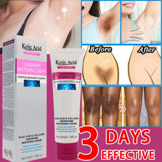 Kojic Acid ครีมขาหนีบดำ 50ml ครีมทาขาหนีบดำ ครีมทารักแร้ขาว …