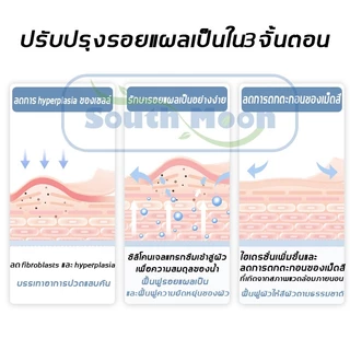 【จัดส่งจากกรุงเทพฯ】South Moon รักษารอยแผลเป็น แผ่นแปะแผลเป็น 4cm*150cm กําจัดรอยแผลเป็นจากแผลเป็น เผยผิวเนียนสวย