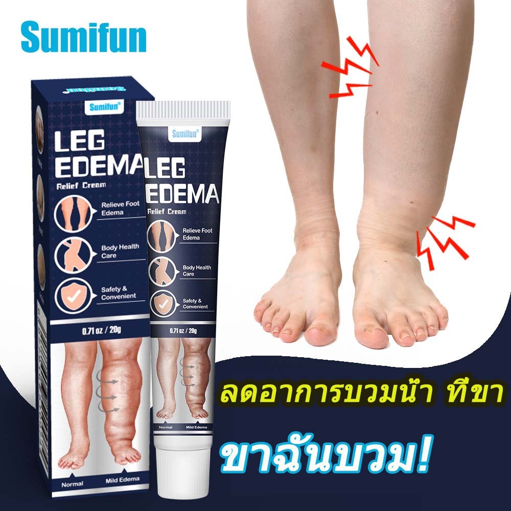 🔥กำจัดโรคบวม🔥ขาบวม ครีมลดอาการบวมนวด ลดน้ำหนัก 20g