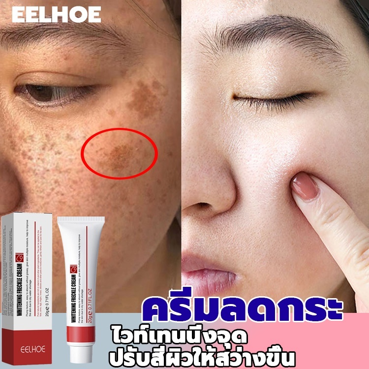 🔥EELHOE ครีมกําจัดฝ้า 20g บอกลาปัญหากระ กำจัดฝ้าจุดด่างดำฝ้ากระ ลดเม็ดสีเ