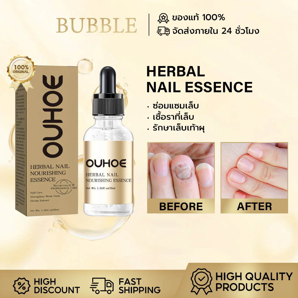 OUHOE เซรั่มบำรุงเล็บ แก้เชื้อราที่เล็บ ซ่อมแซมเล็บ เล็บขบ ซ่อมแซมเล็บแตก Nail Serum 30ML