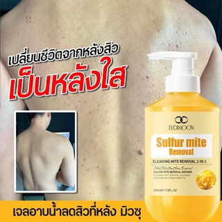 LYDIMOON เจลอาบน้ำแอนตี้แบคทีเรีย สบู่อาบน้ํา เจลอาบน้ำแก้คัน 500ml กำมะถันครีมอาบน้ำ ลดรอยดำ ผดผื่น สิวหลัง หน้าอก หลัง