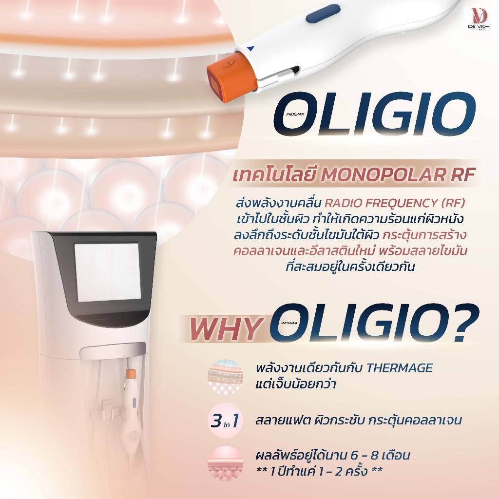 Oligio 300 Shots แถมฟรี Ultraformer 150 Shots | ผิวกระชับ สลายแฟต กระตุ้นคอลลาเจน | De Vich Clinic [