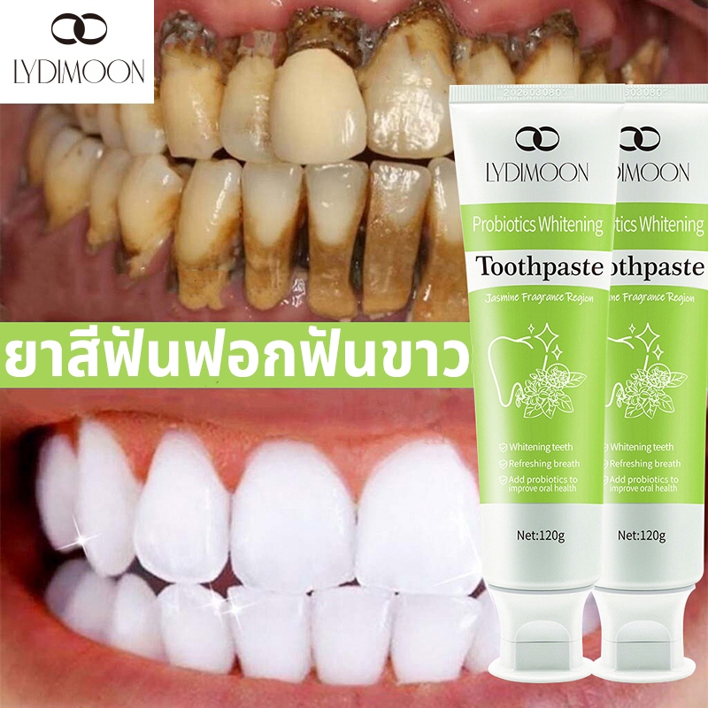 LYDIMOON ยาสีฟันฟอกฟันขาว ยาสีฟันฟันขาว ยาสีฟัน 120g ขจัดคราบเหลือง ฟอกฟันขาวขจัดคราบหินปูน ฟอกฟันขา